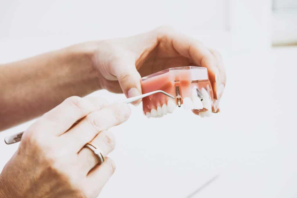 Implants Dental Innovations 